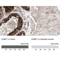 EHBP1 Antibody, Novus Biologicals 25 &mu;L, Unlabeled:Antibodies, Polyclonal